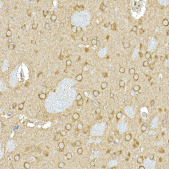 Calumenin Rabbit monoclonal antibody