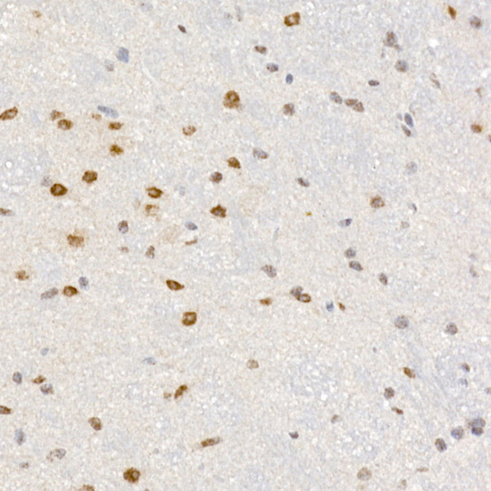 PCBD1 Rabbit monoclonal antibody