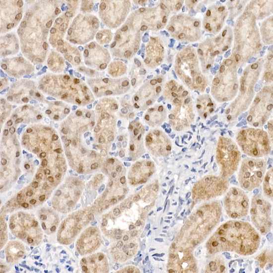 PCBD1 Rabbit monoclonal antibody
