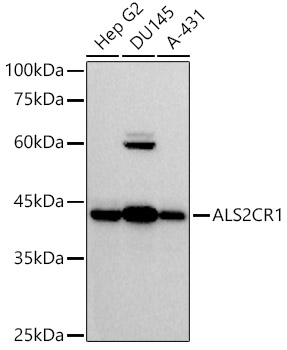 ALS2CR1 Rabbit monoclonal antibody