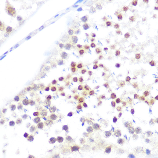 NUP50 Rabbit polyclonal antibody