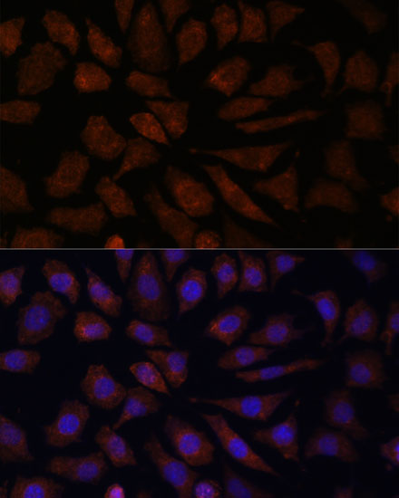 OAS3 Rabbit polyclonal antibody