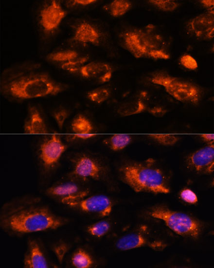 OAS3 Rabbit polyclonal antibody