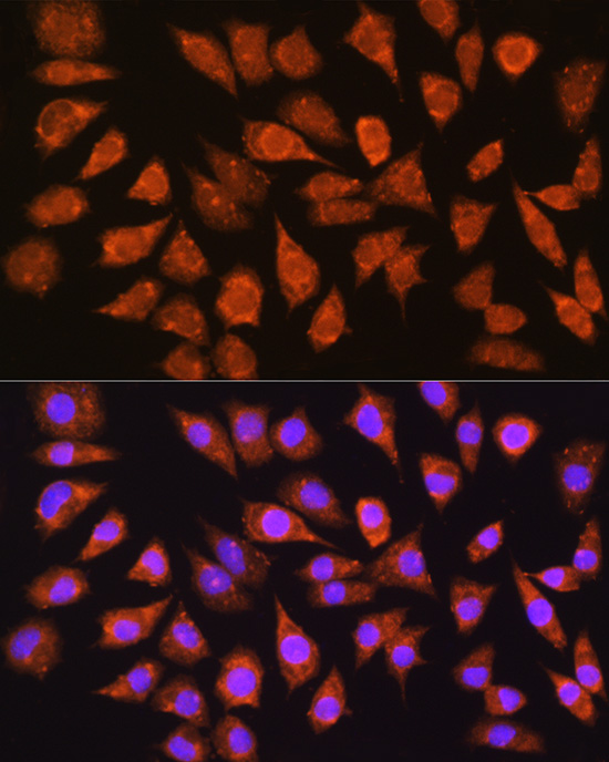 IMPDH1 Rabbit polyclonal antibody