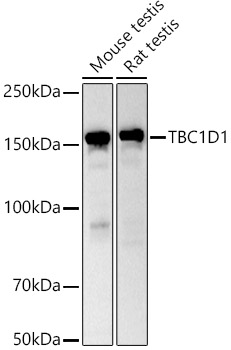 TBC1D1 Rabbit polyclonal antibody