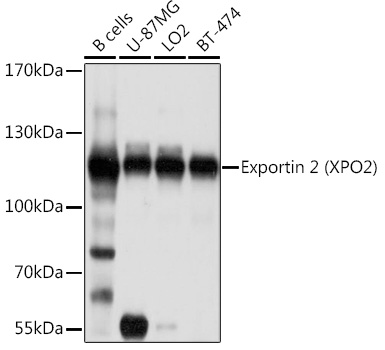 Exportin 2 (XPO2) Rabbit pAb