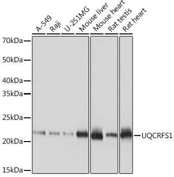 UQCRFS1 Rabbit monoclonal antibody