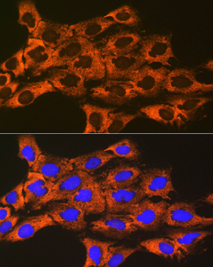 UQCRFS1 Rabbit monoclonal antibody