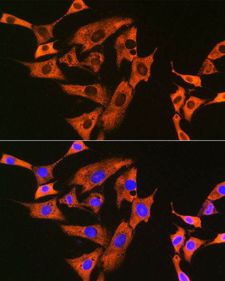 UQCRFS1 Rabbit monoclonal antibody