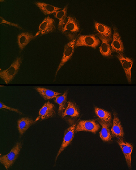 UQCRFS1 Rabbit monoclonal antibody