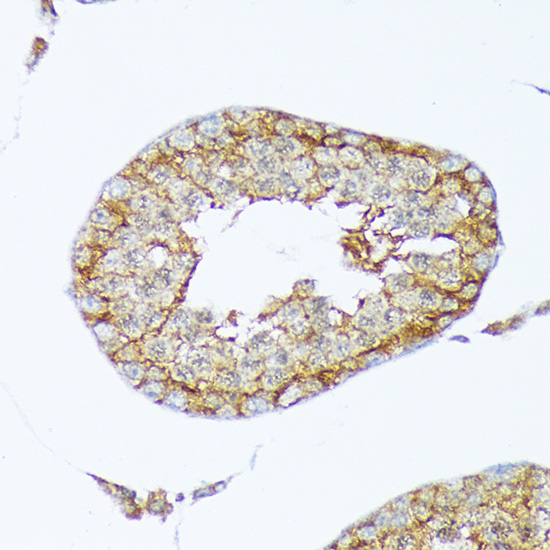 Cortactin Rabbit monoclonal antibody
