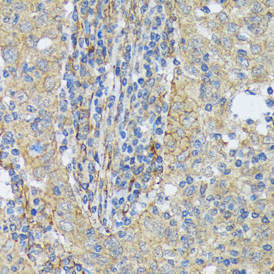 Cortactin Rabbit monoclonal antibody