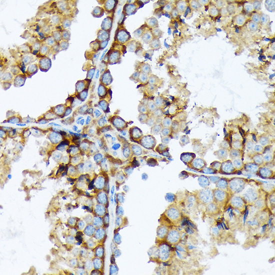 Cortactin Rabbit monoclonal antibody
