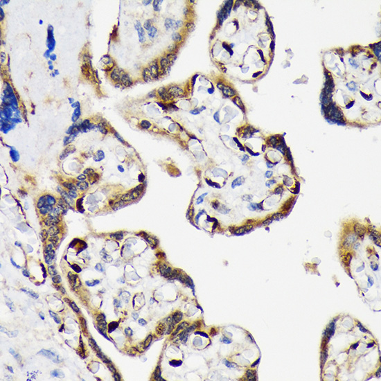 LIN28B Rabbit monoclonal antibody