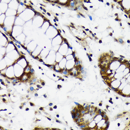 CDC5L Rabbit monoclonal antibody