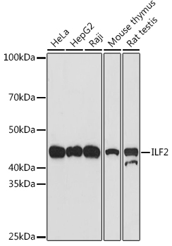 ILF2 Rabbit monoclonal antibody