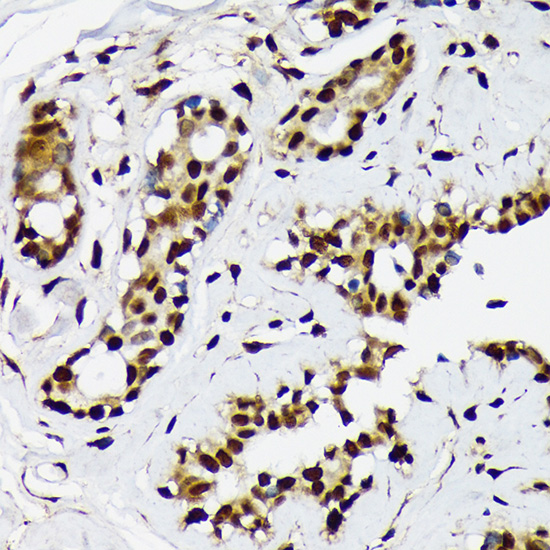 ILF2 Rabbit monoclonal antibody