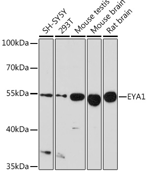 EYA1 Rabbit polyclonal antibody