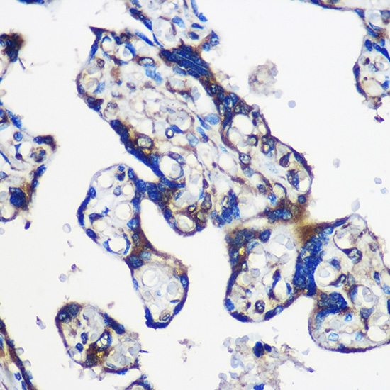 EYA1 Rabbit polyclonal antibody