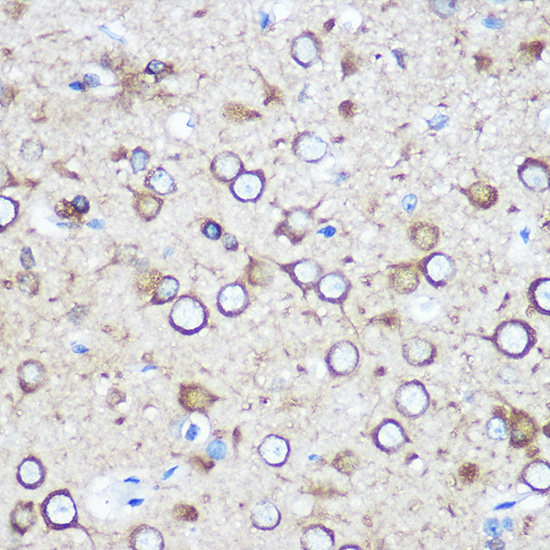 EYA1 Rabbit polyclonal antibody