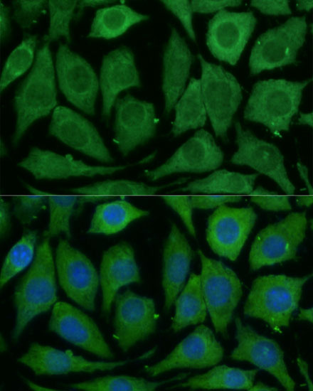 SARDH Rabbit polyclonal antibody