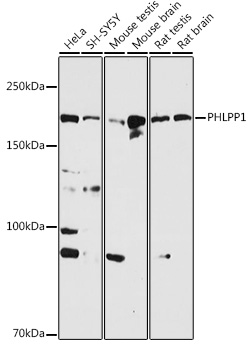 PHLPP1 Rabbit polyclonal antibody