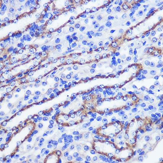 PHLPP1 Rabbit polyclonal antibody