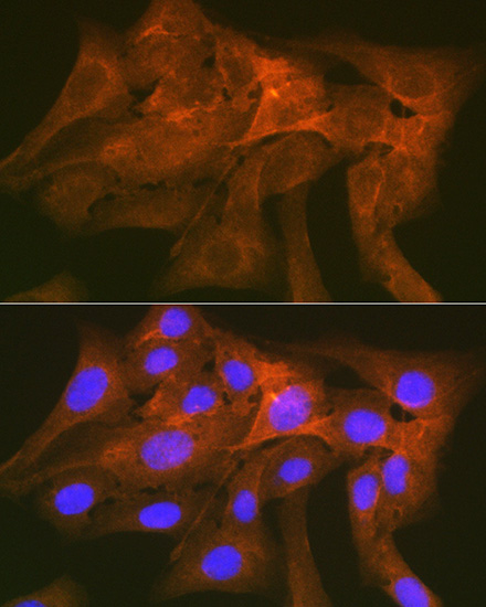 CD172a/SIRPA Alpha Rabbit monoclonal antibody