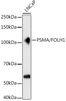 PSMA/FOLH1 Rabbit monoclonal antibody