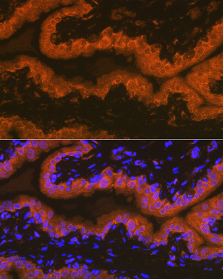 PSMA/FOLH1 Rabbit monoclonal antibody
