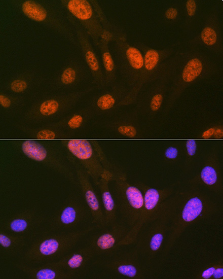 HIPK2 Rabbit monoclonal antibody