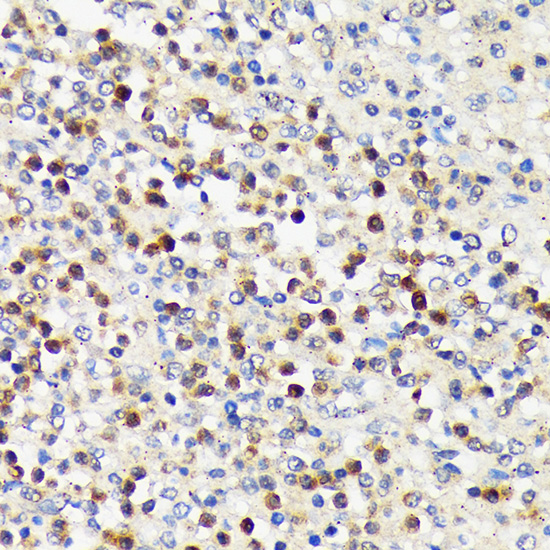 CD5 Rabbit monoclonal antibody