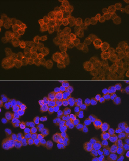 CD5 Rabbit monoclonal antibody