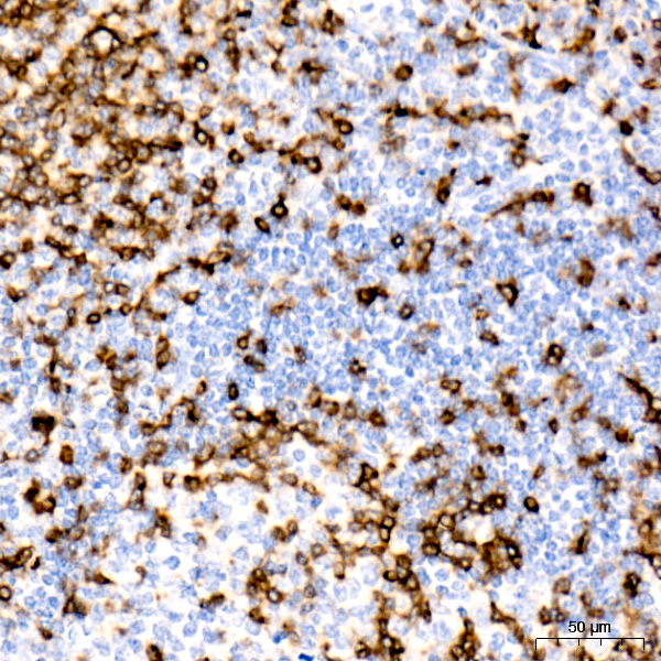 CD7 Rabbit monoclonal antibody