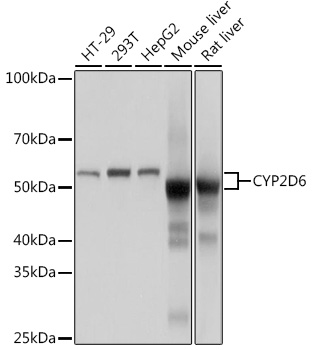 CYP2D6 Rabbit monoclonal antibody