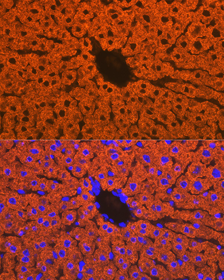 CYP2D6 Rabbit monoclonal antibody
