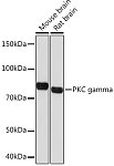 Western blot - PKC gamma Rabbit mAb (A9565)