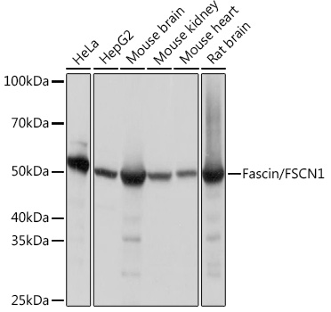 Fascin/FSCN1 Rabbit monoclonal antibody