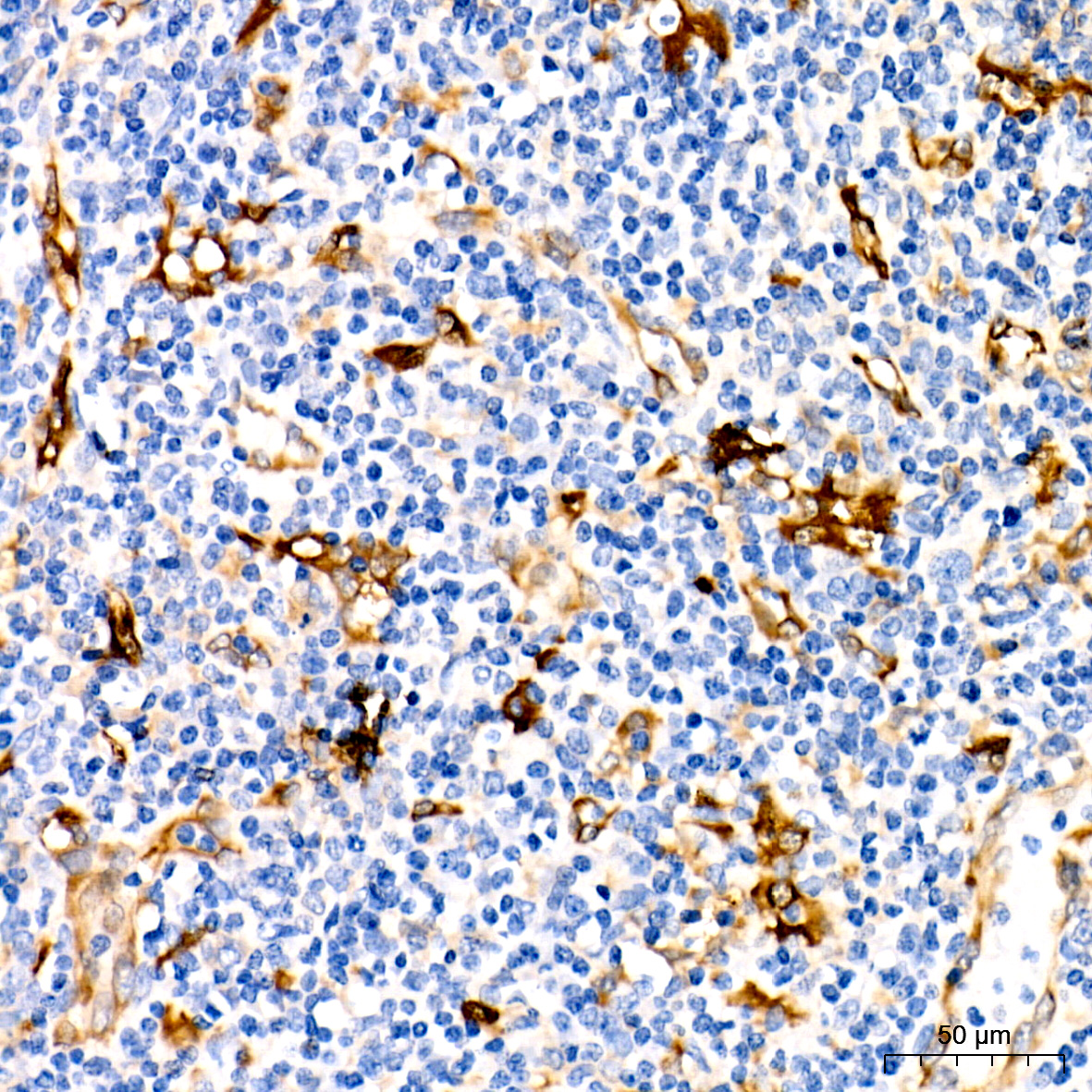 Fascin/FSCN1 Rabbit monoclonal antibody