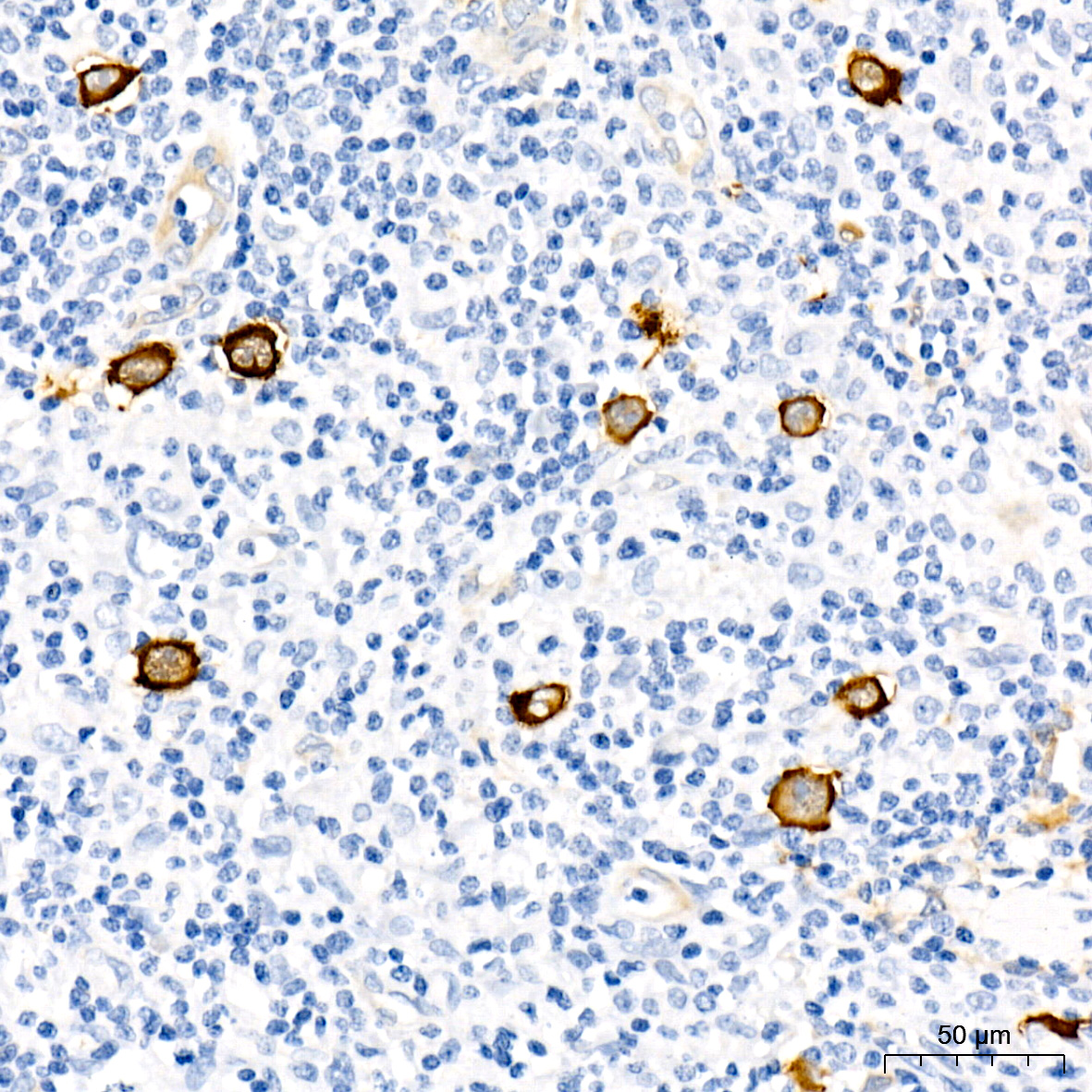 Fascin/FSCN1 Rabbit monoclonal antibody