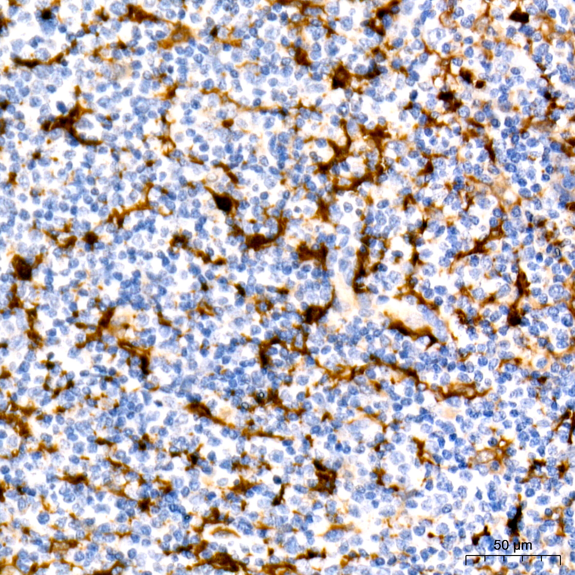 Fascin/FSCN1 Rabbit monoclonal antibody