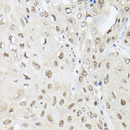 UBQLN2 Rabbit polyclonal antibody