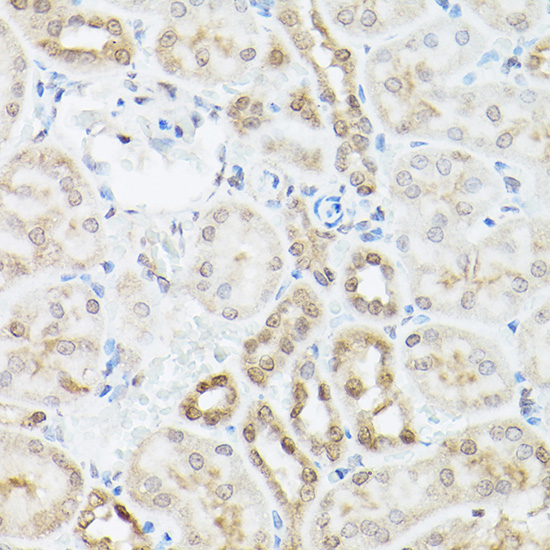 UBQLN2 Rabbit polyclonal antibody