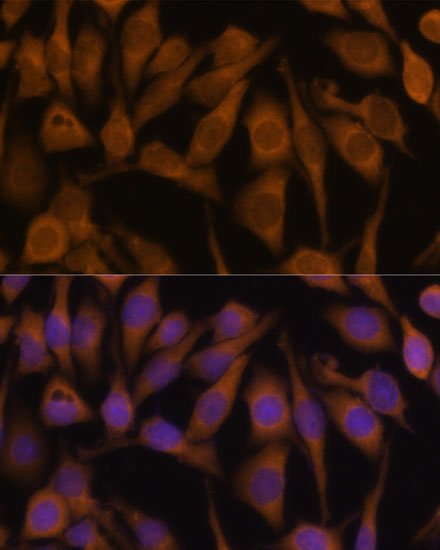 UBQLN2 Rabbit polyclonal antibody