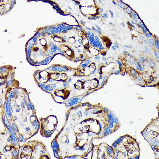 Apolipoprotein CI Rabbit monoclonal antibody