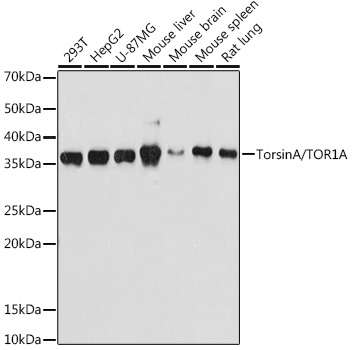 TorsinA/TOR1A Rabbit mAb