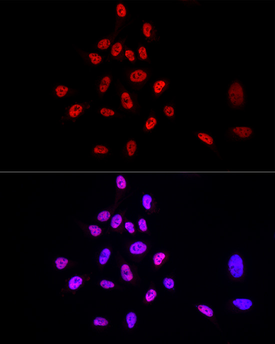 TRA2B Rabbit polyclonal antibody