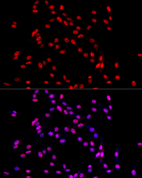 TRA2B Rabbit polyclonal antibody