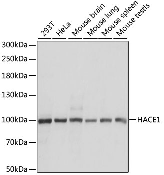 HACE1 Rabbit polyclonal antibody