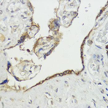 HACE1 Rabbit polyclonal antibody
